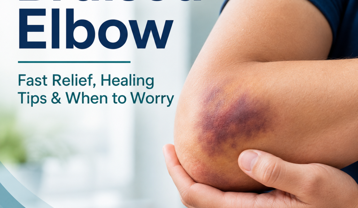 Bruised Elbow: Fast Relief, Healing Tips & When to Worry